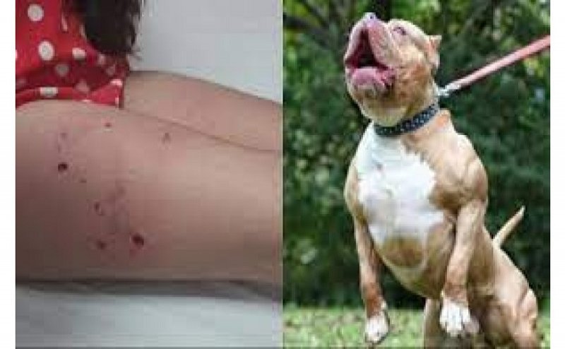 गाजियाबाद में फिर दिखा पिटबुल का आतंक, सोसायटी में खेल रही बच्ची पर कुत्ते ने किया हमला