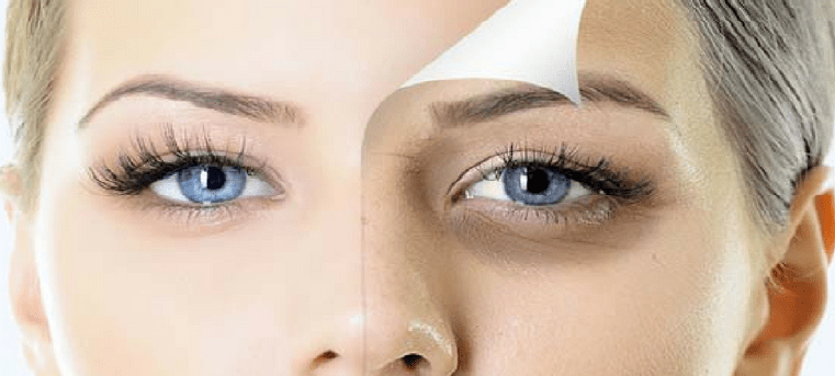 eye patches to get rid of dark circles