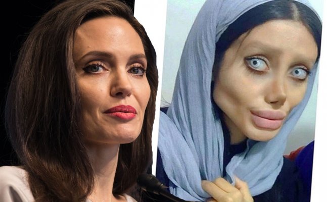 Iranain teenager undergoes 50 surgeries to look like Angelina Jolie